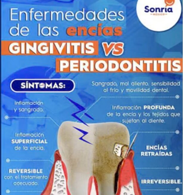 sonria1
